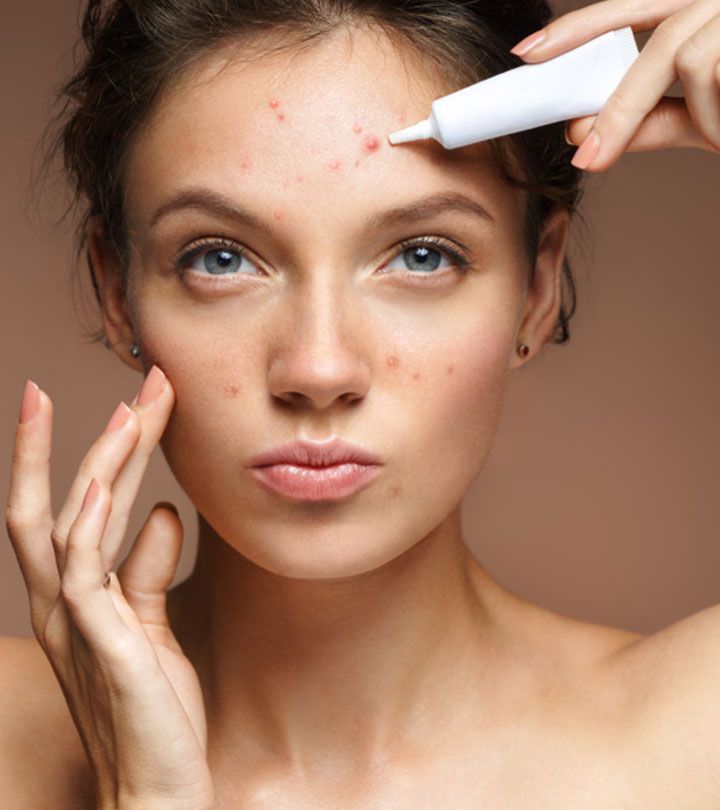 Acne Control